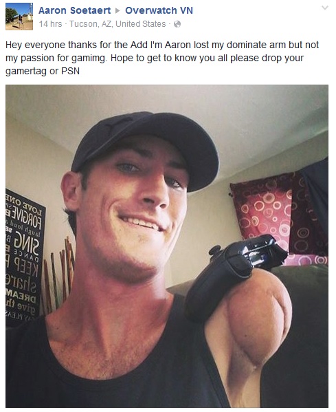 Game thủ không may mắn mất đi cánh tay gửi lời chào đến các game thủ Overwatch Việt Nam