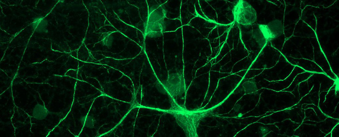 Não bộ chúng ta luôn có xu hướng dự đoán tương lai, bạn có nhận ra điều đó không?