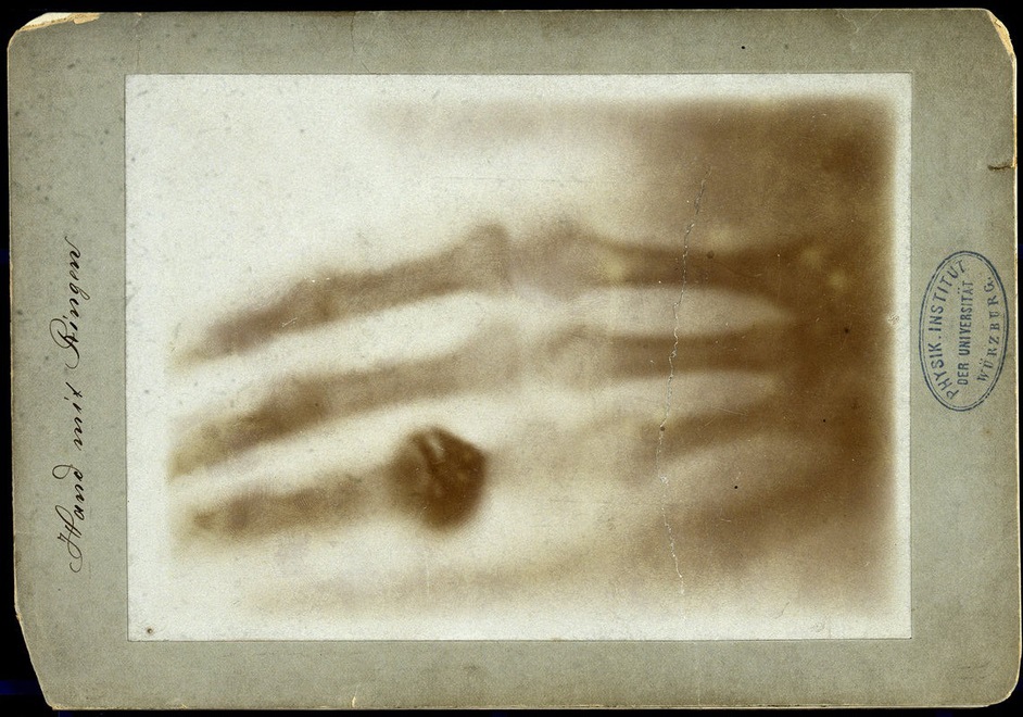 Tia X là gì và nó đã được phát triển như thế nào?