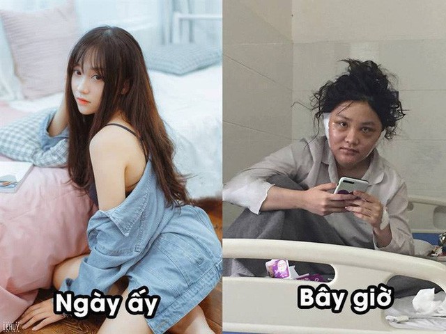 Kiều Anh Hera lột xác hé lộ hình lột xác sau phẫu thuật thẫm mỹ không kém gì Video 9 GB