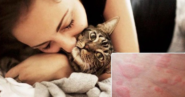 Yêu mèo đến điên dại mà ở gần là ngứa hết cả người? Bi kịch của các "sen" nay sắp chấm dứt rồi