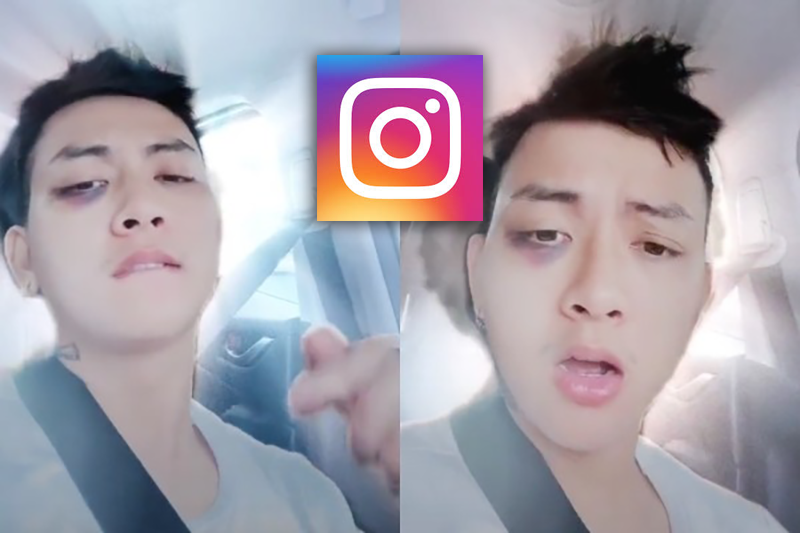 Cách tạo mặt theo trend hiệu ứng bầm mặt cực nổi tiếng trên Instagram