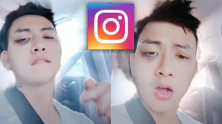 Cách tạo mặt theo trend hiệu ứng bầm mặt cực nổi tiếng trên Instagram