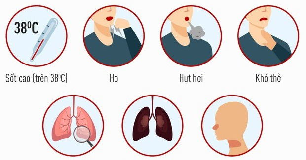 Tổng hợp các biểu hiện triệu chứng nhiễm Covid-19