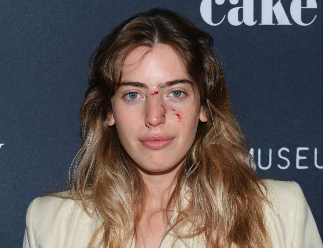 Con gái ngôi sao Stars War mang gương mặt vừa bị chó cắn chảy máu lên thảm đỏ khiến dân tình hoang mang cực độ