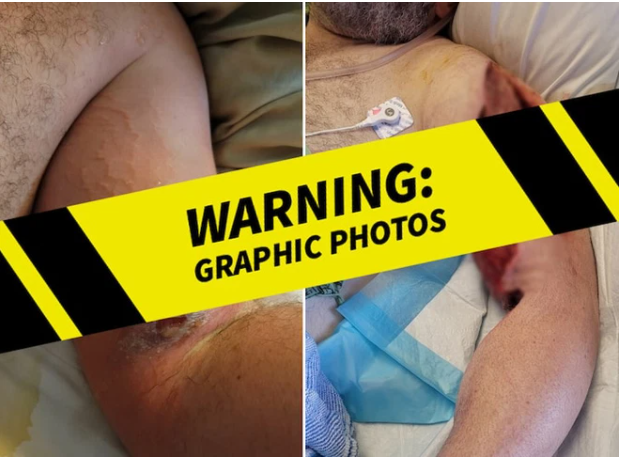 Tai nạn khác tại phim trường Rust sau vụ diễn viên bắn chết người khiến dân tình nổi gai óc