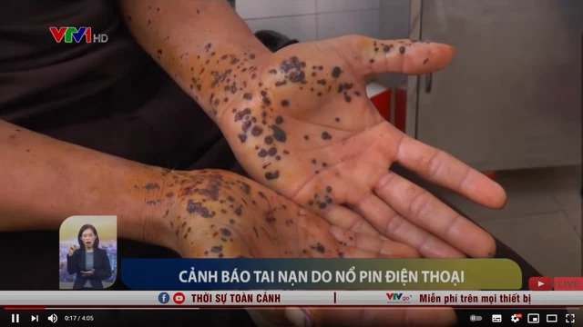 Từng được cảnh báo rất nhiều nhưng những tai nạn do vừa dùng điện thoại vừa sạc vẫn diễn ra