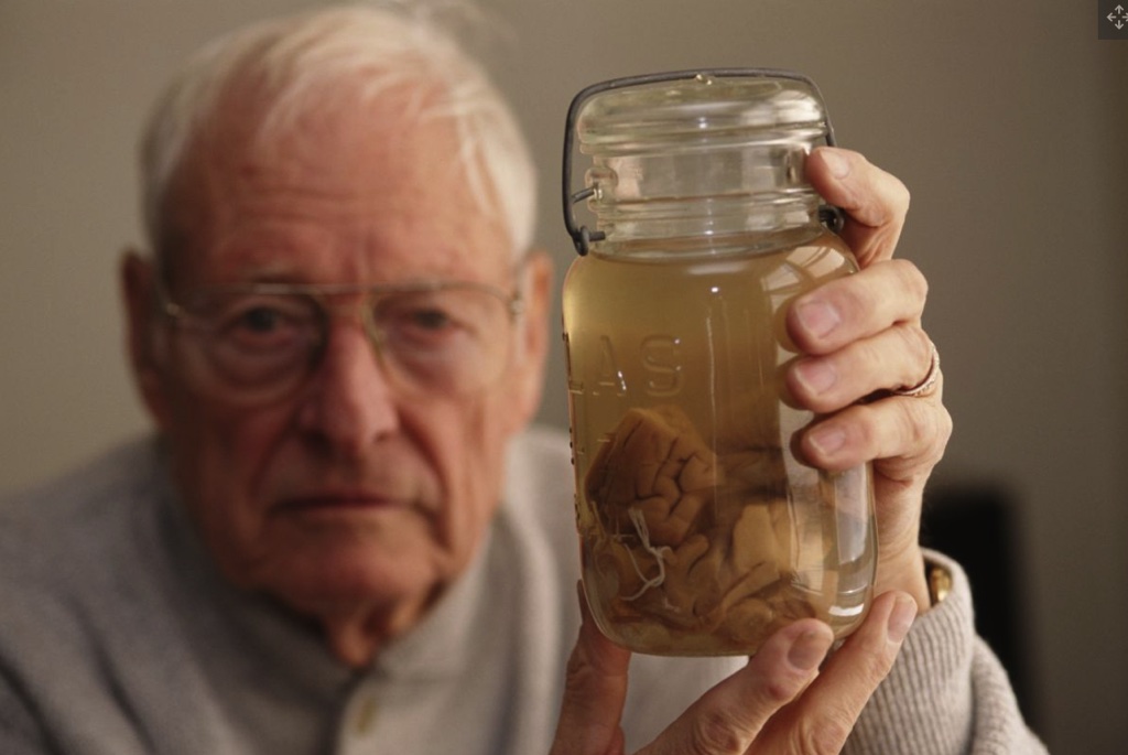 Bộ não của nhà vật lý vĩ đại, Albert Einstein hiện tại đang ở đâu? 