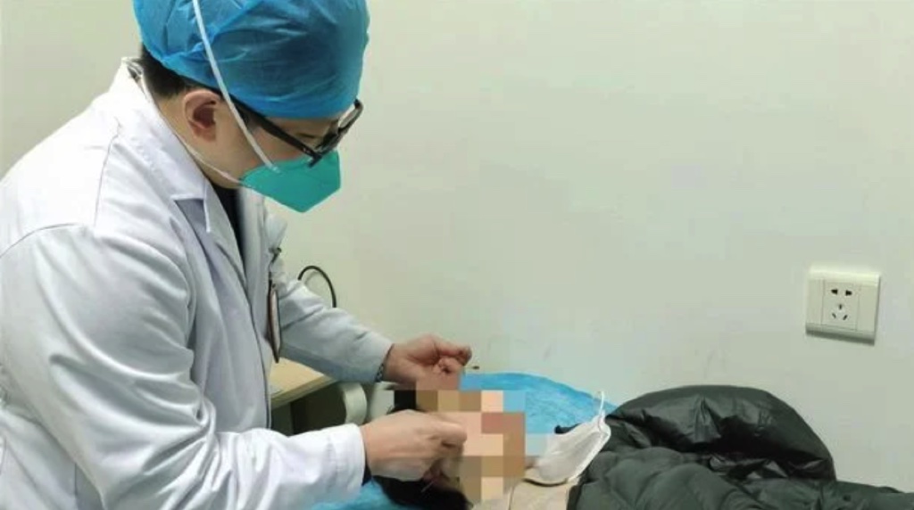 Một người đàn ông bị liệt nửa mặt sau khi thức suốt một tuần để xem World Cup