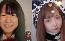 Cô gái người Nhật thừa nhận từng phẫu thuật từ năm 11 tuổi vì ngoại hình không như mong muốn