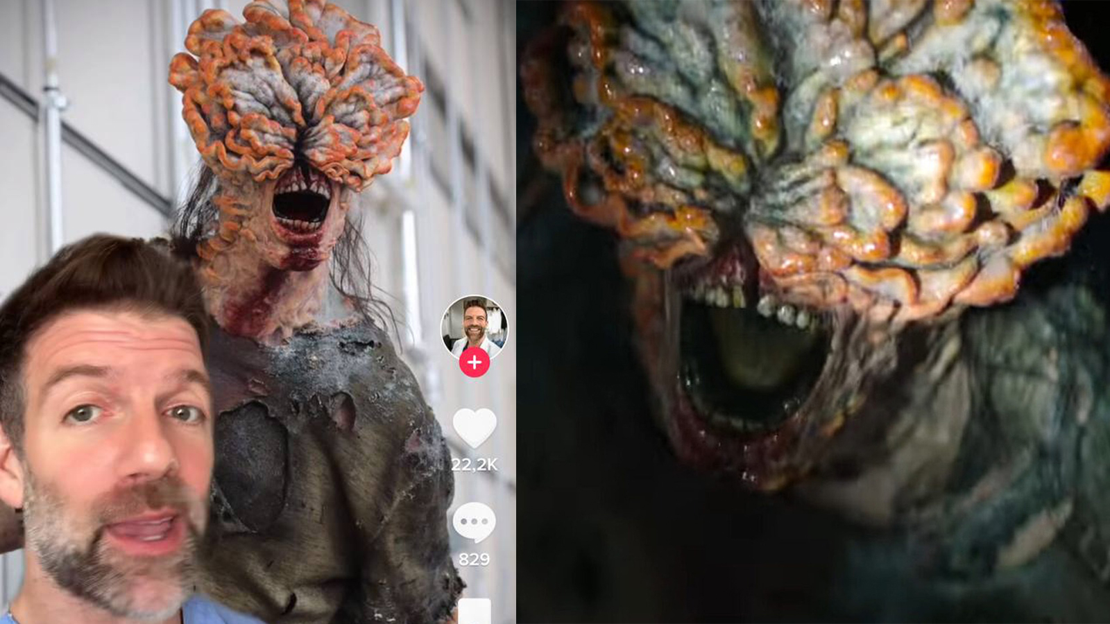 TIktok lan truyền thông tin về loại nấm nguy hiểm đang lây lan trên đất Mỹ biến người thành Zombie như trong The Last of Us