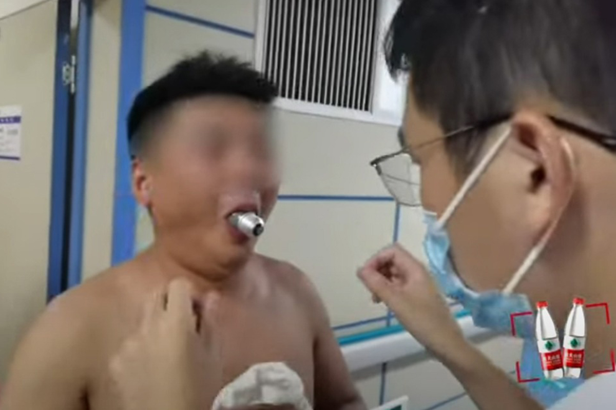 Người đàn ông bị kẹt bóng đèn trong miệng vì thực hiện thử thách ngớ ngẩn trên mạng