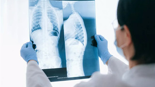 Tương tự như bác sĩ, AI có thể phân tích bệnh từ ảnh chụp X-quang