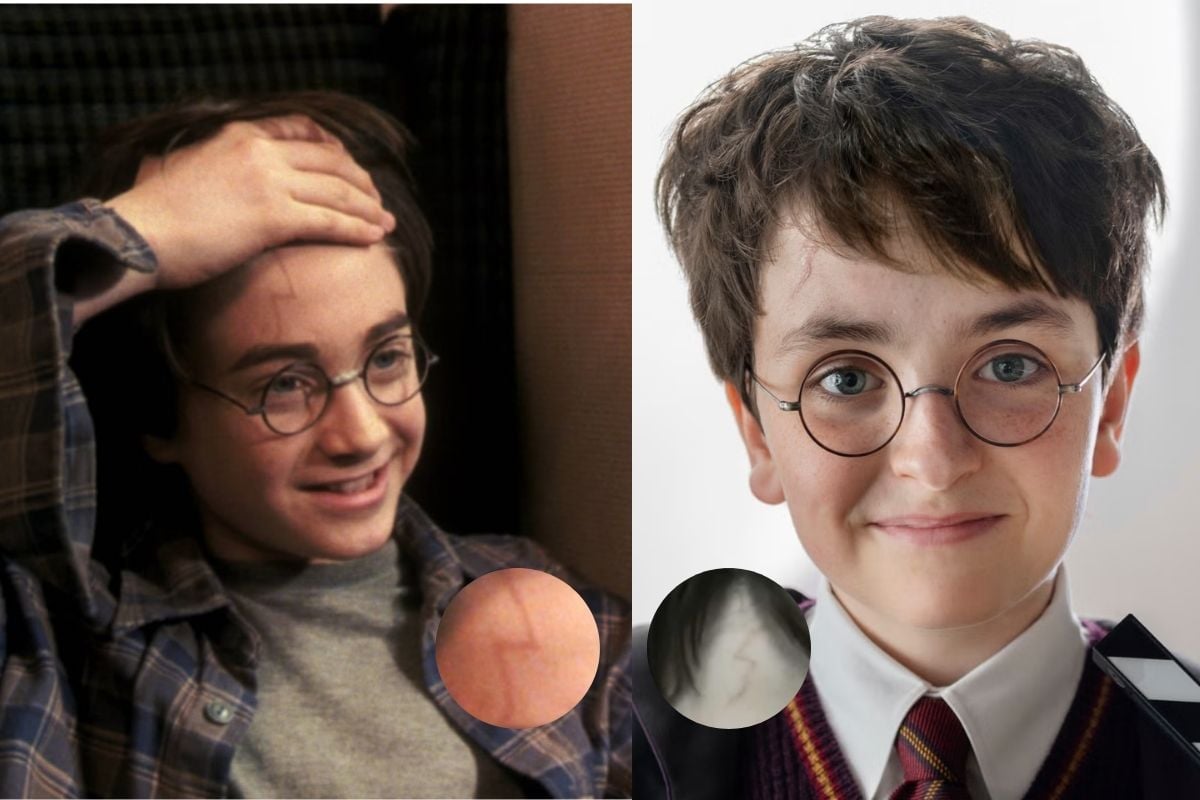 Harry Potter HBO Hé Lộ Thiết Kế Vết Sẹo Mới Của Harry